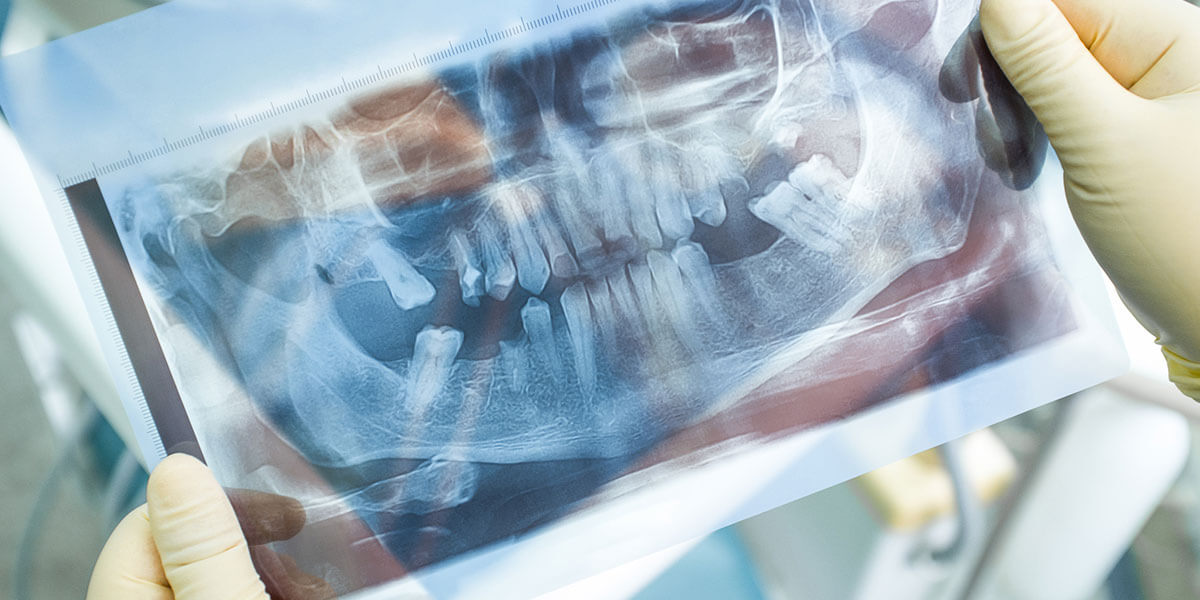 Bone-Grafting-Page.jpg