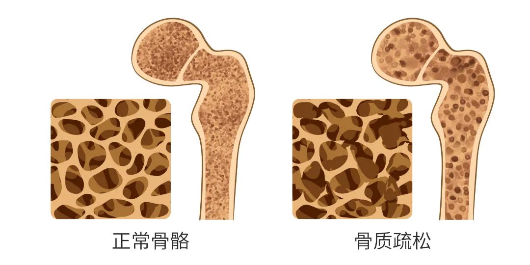 骨骼结构比较.jpg 骨骼结构比较.jpg