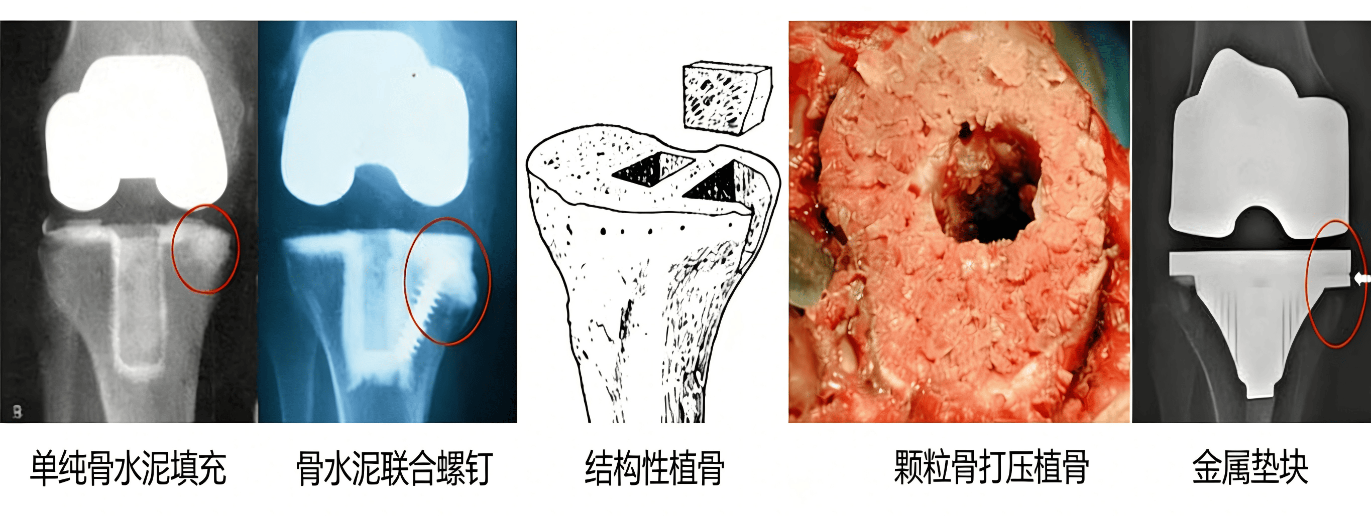 去除公众号水印(1) (1).png 去除公众号水印(1) (1).png