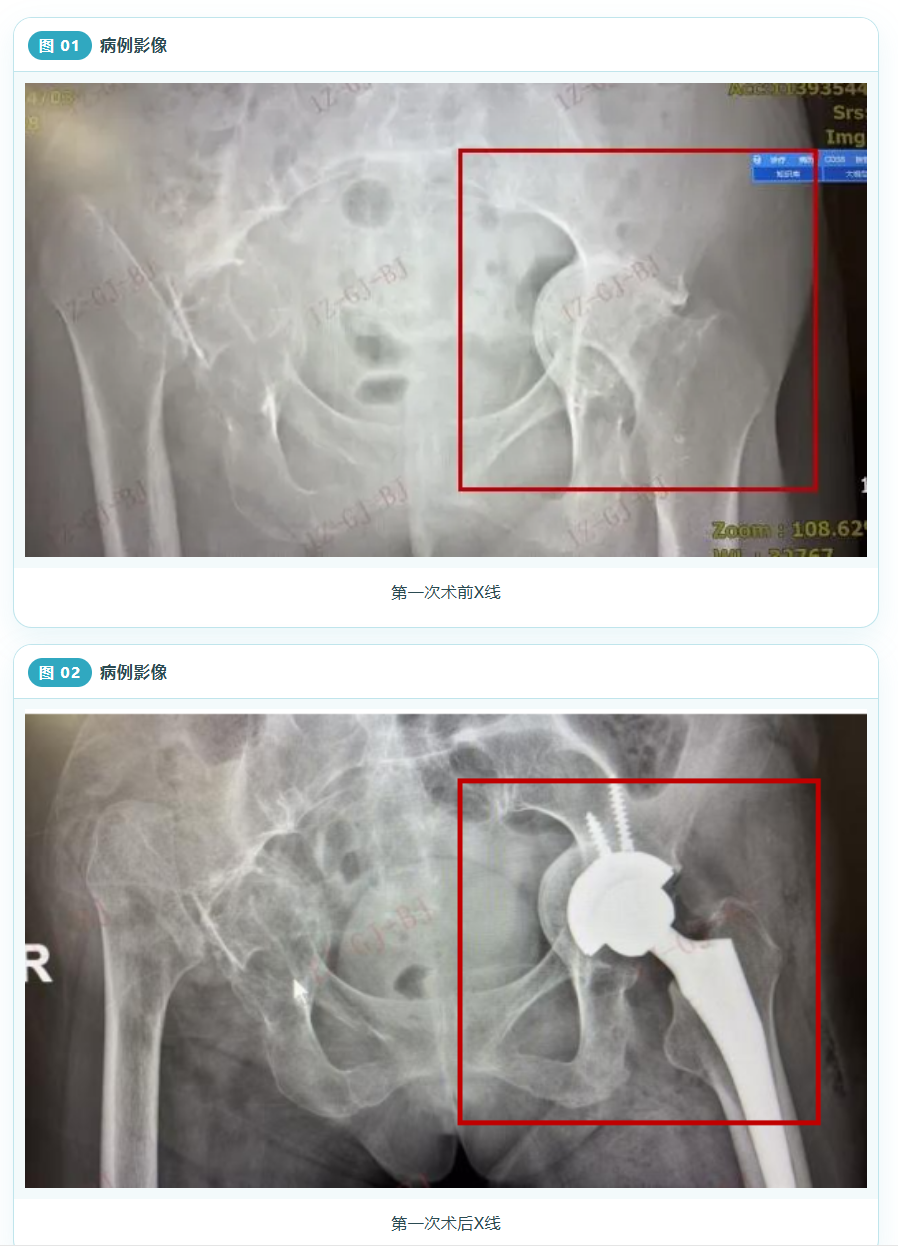 image.png image.png